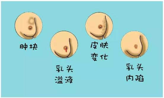 乳腺增生肿块