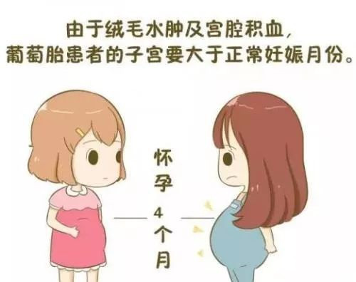 葡萄胎是怪胎吗？它是如何形成的？