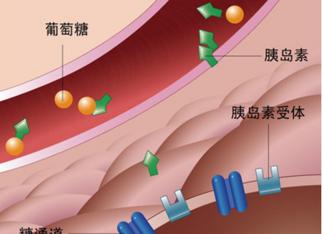 为什么胰岛素抵抗原发性与继发性不同？