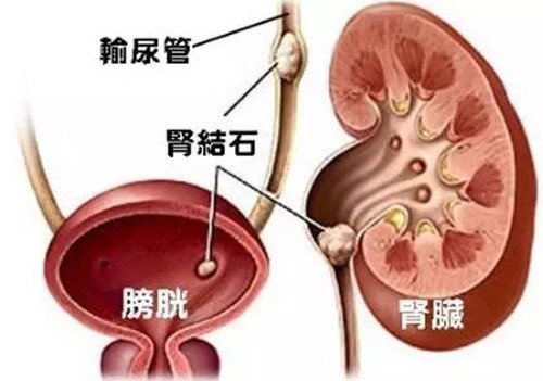 为什么磺胺异噁唑主要用于泌尿系感染？