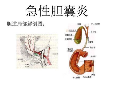 哪些临床表现提示患了急性胆囊炎？慢性胆囊炎有哪些表现？