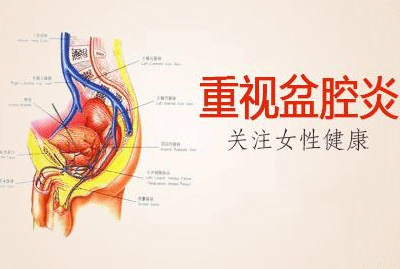 盆腔炎性病理