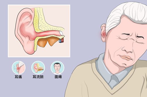 为什么人会患外耳道炎？有几种？各有哪些临床表现？