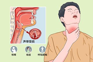    喉炎有哪些临床表现？