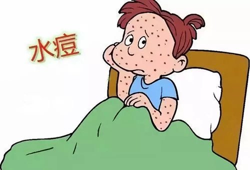 水痘要怎么样治疗才能好呢